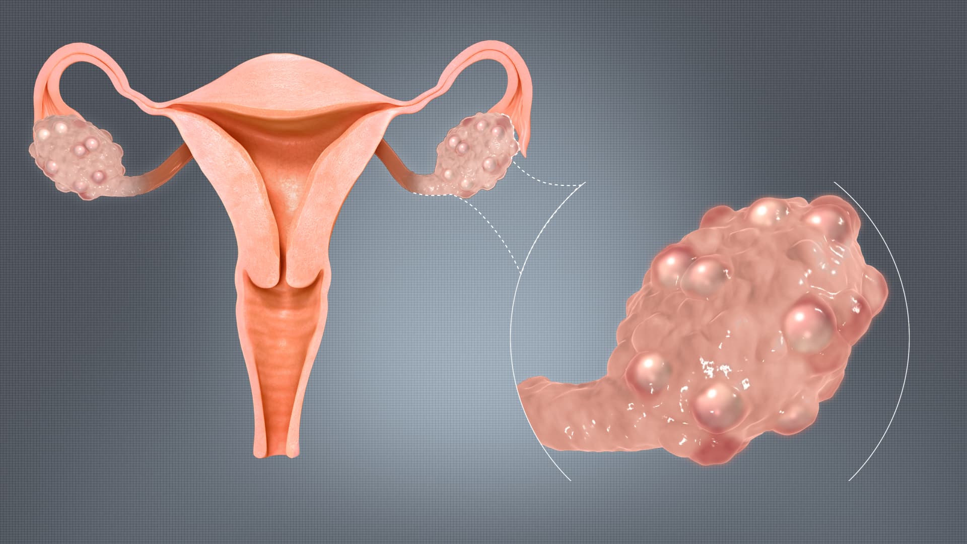 Les ovaires et fertilité féminine